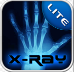 X-ray